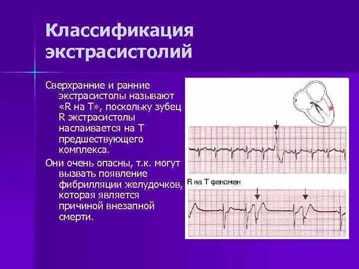Признаки t r