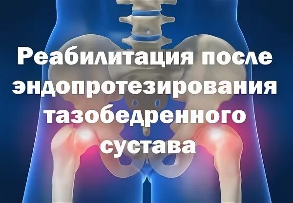 Реабилитация после эндопротезирования тазобедренного сустава. Эндопротезирование тазобедренного сустава операция. Операция на тазобедренном суставе реабилитация. Ограничения после эндопротезирования тазобедренного сустава. Форум после тазобедренной операции