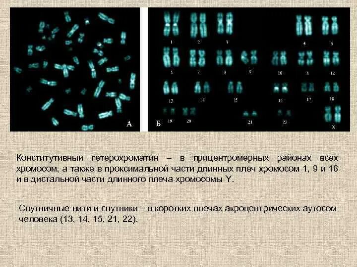 Уменьшение числа отдельных хромосом в кариотипе. Спутничные хромосомы в кариотипе человека. конститутивный гетерохроматин. цитогенетика. конститутивный гетерохроматин расположен в.