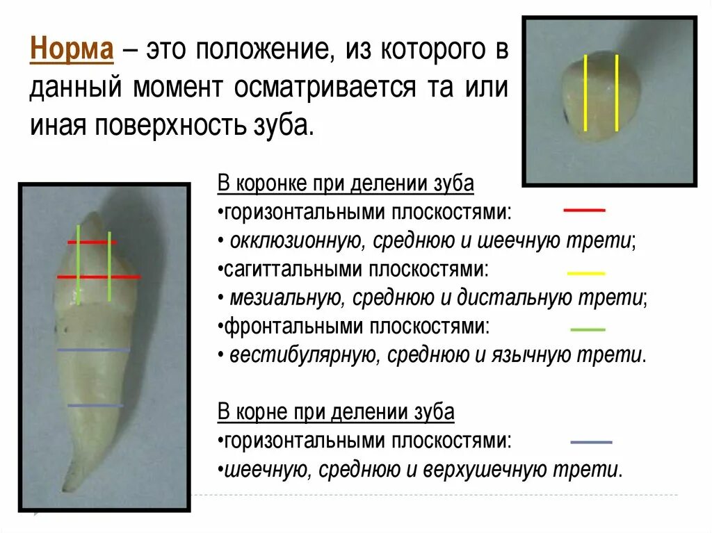 Понятие о норме зуба. Деление коронки и корня.