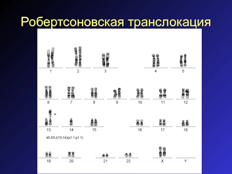 Носителем транслокации