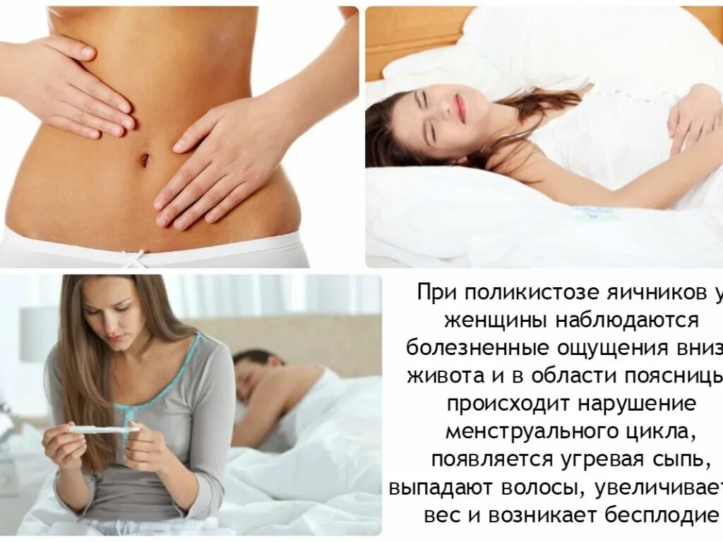 Как определить боли яичников. Поликистоз яичников симптомы. симптомы при поликистозе яичников. поликистоз яичника симптомы. поликистоз яичников симп.