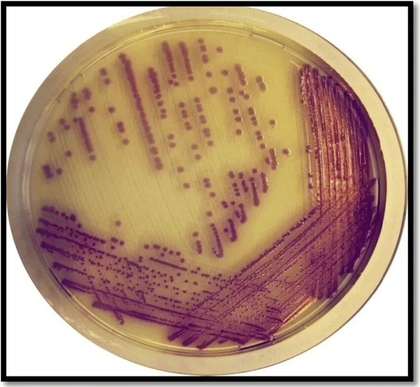 Salmonella typhi микробиология. Salmonella typhi на среде. Возбудитель брюшного тифа микробиология. Посев на сальмонеллез