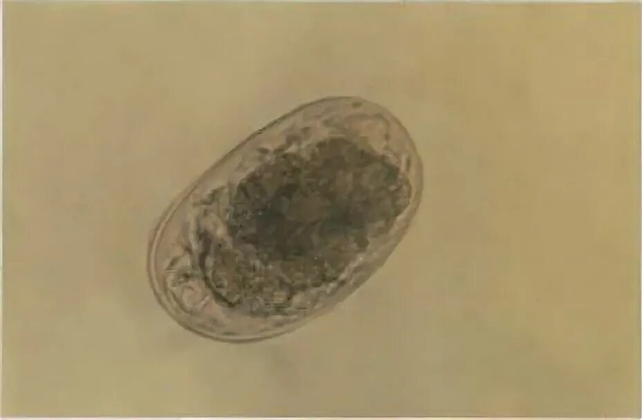 Яйца гельминтов Ancylostoma caninum. Яйца гельминтов плотоядных. Яйца гельминтов плотоядных животных. Купить яйца глист