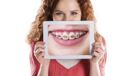 Get teeth