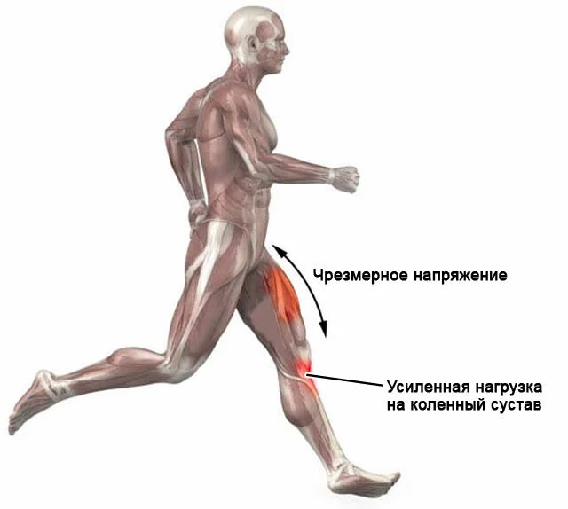 После бега болят колени что делать. Тендинит сухожилия четырехглавой мышцы коленного сустава. Нагрузка на мышцы при беге. Мышцы которые задействуются при беге. Нагрузка на суставы при беге.