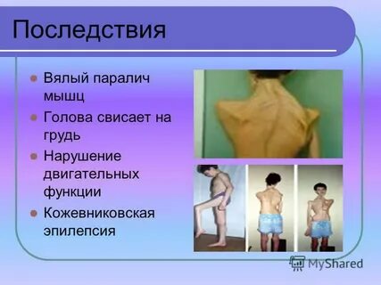 Почему стал вялым