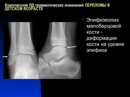 Травматические изменения