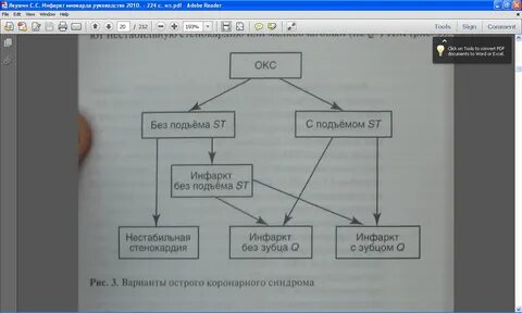 Инфаркт миокарда дипломная