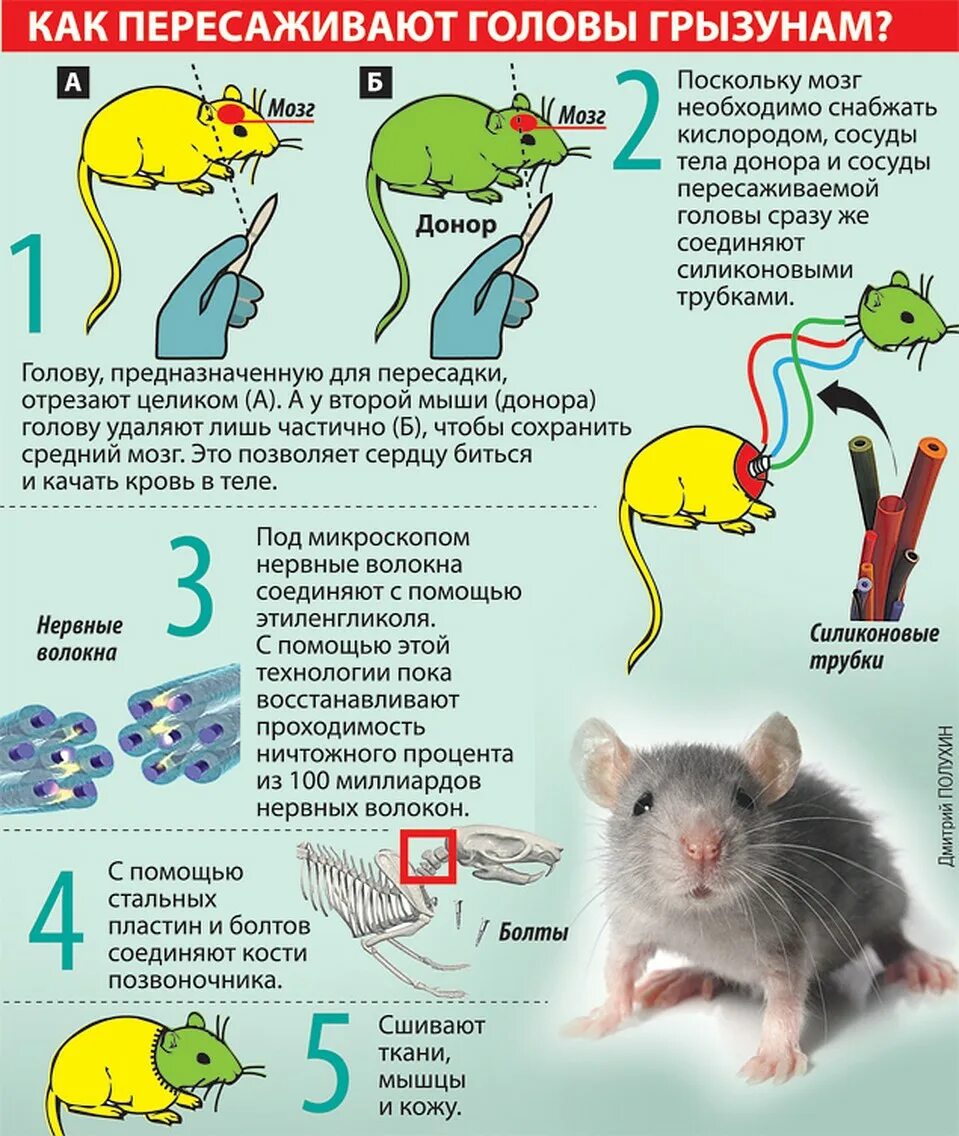 Как пересадить мозги