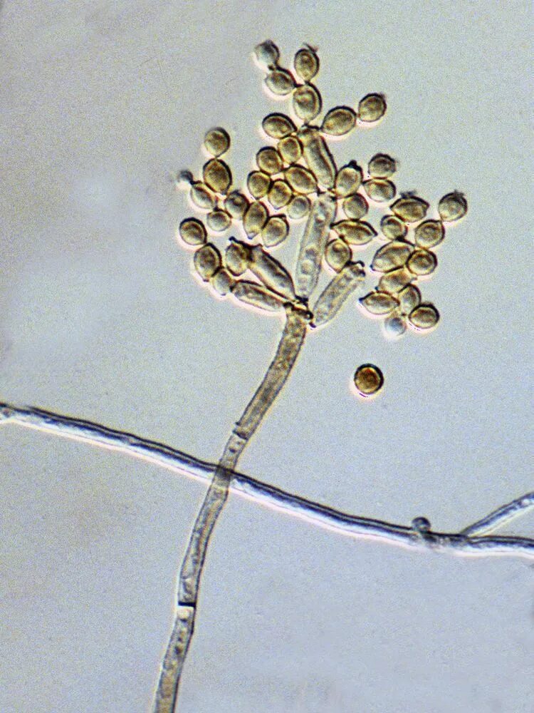 Патогенные грибы споры. Cladosporium resinae. Cladosporium herbarum конидии. Грибы Cladosporium. Кладоспориум и альтернария.