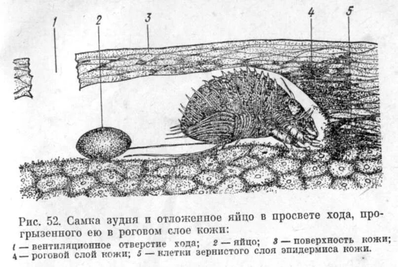 Жизненный цикл чесоточного клеща схема. Чесоточный зудень цикл. Чесоточный клещ жизненный цикл. Sarcoptes scabiei жизненный цикл. Цикл развития чесоточного клеща