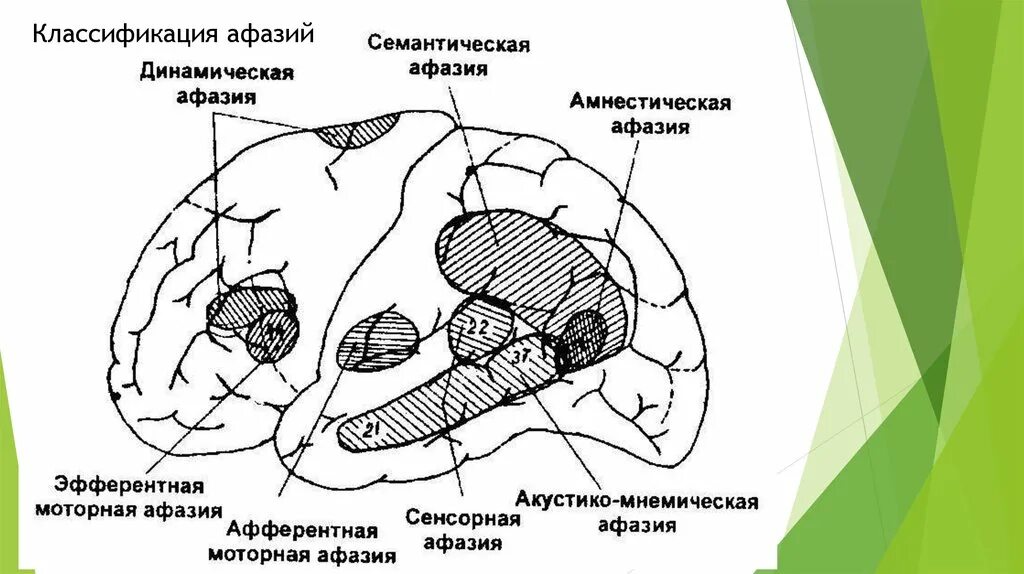 Вестибулярный анализатор физиология. Эфферентная моторная афазия и афферентная моторная афазия. Афферентная сенсорная. Афферентная сенсорная. Эфферентная моторная афазия зона поражения.