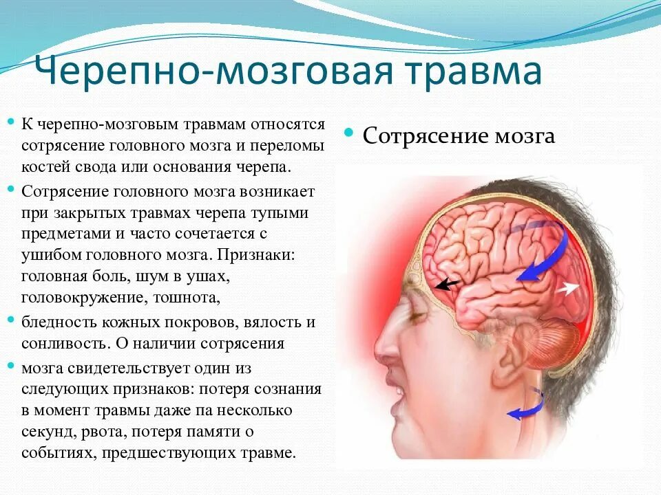 Сотрясение 2. Симптоматика сотрясения головного мозга обуславливается. Три основных признака при сотрясении головного мозга.. Черепно мозговая травма ушиб мозга. Сеоепно мозгоапя Травиа.