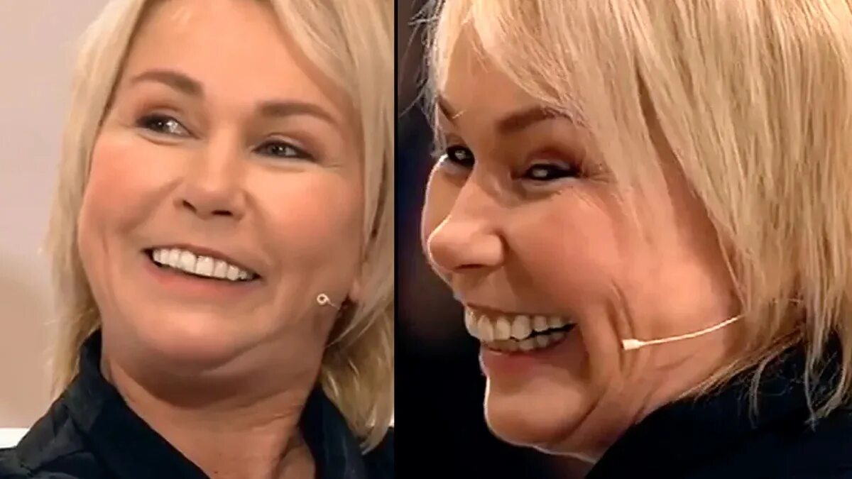 стриж после пластики. стриж после пластики. стриж после пластики. ксения стриж 2021. ксения стриж европа плюс.