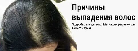 Если она выпадает