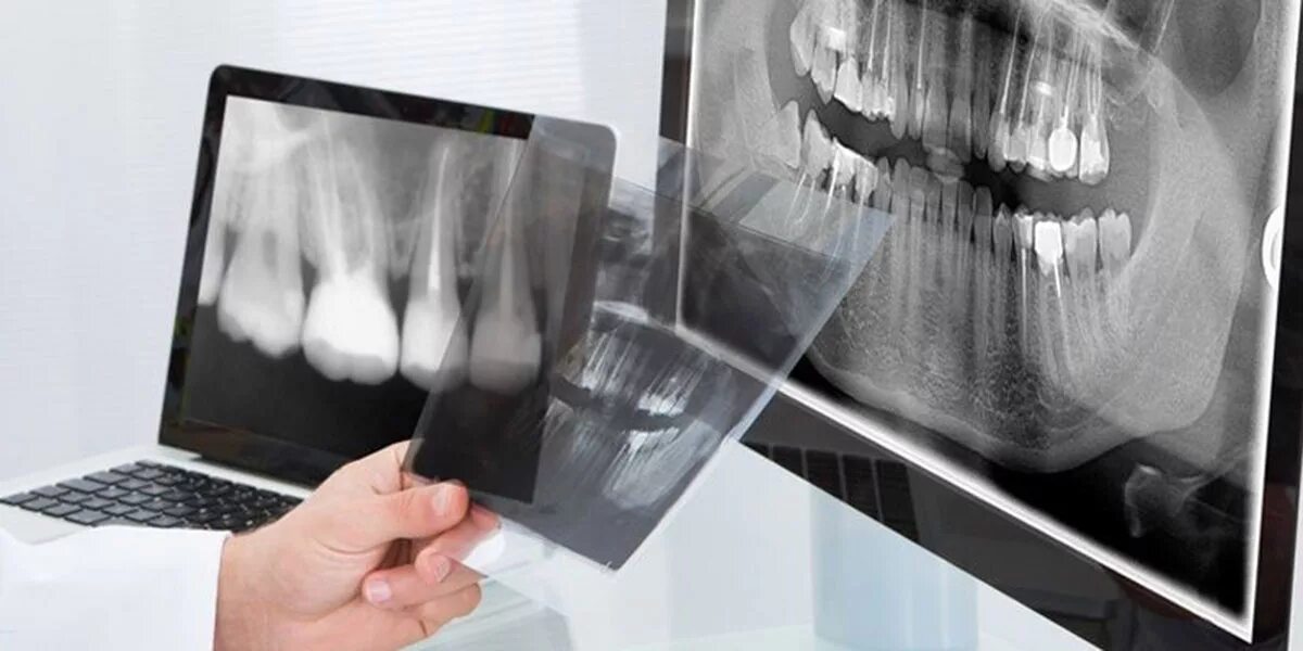 Рентген можно сделать. Ортопантомография (панорамная томография). Кт ОПТГ аппарат. Рентгенологический метод в стоматологии. Системы цифровой рентгенографии стоматология.