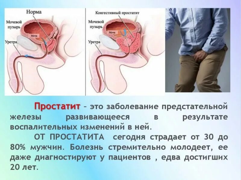 Предстательная железа у мужчин. Предстательная железа функции. Функция предстательной железы у мужчин. Функции простаты.