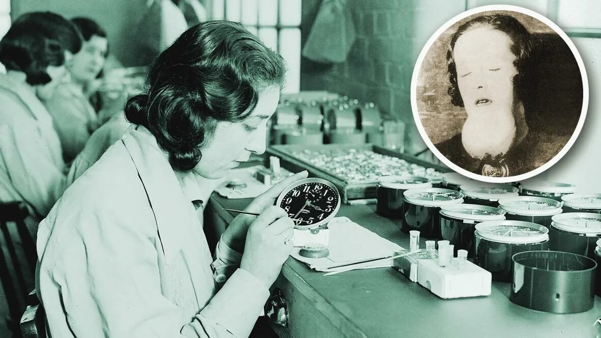 Радивая челюсть фото. Радиевые девушки грейс фрайер 1899-1933. Молли мэгги радиевая девушка. Радивая челюсть фото. Радиевые девушки челюсть.