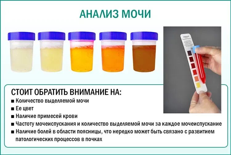Моча утром форум. Моча с примесью крови. Анализ мочи цвет. Кровь в моче цвет мочи. Больной цвет мочи.