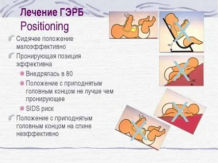 Рефлюкс у новорожденных