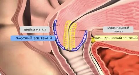 Канал матки закрыт