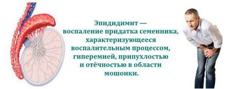 Болит яичко у мужчины. Эпидидимит воспаление придатка. Воспаление придатка яичка. Воспалённый придаток яичка. Воспаление придатка яичк.