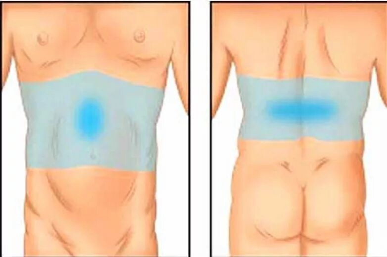 Панкреатит болит спина. Острый панкреатит локализация боли. Локализация боли при остром панкреатите. Хронический панкреатит локализация боли. Опоясывающая боль при панкреатите локализация.