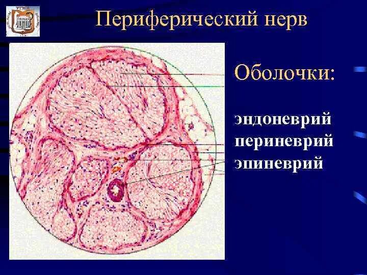 Нерв гистология. Поперечный разрез нерва эндоневрий периневрий. строение нерва эпиневрий периневрий эндоневрий. периферический нерв гистология. эндоневрий периневрий эпиневрий строение нерва гистология.