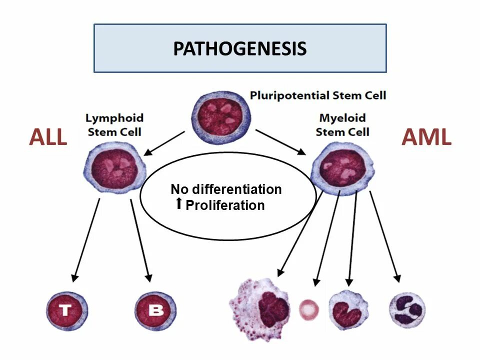 Aml проверка cryptozen. Leukemia pathogenesis. Pathogenesis of acute Leukemia. Chronic myeloid Leukemia. Pathogenesis of CML.