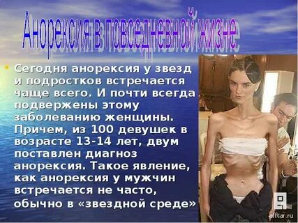Какой вес считается анорексией