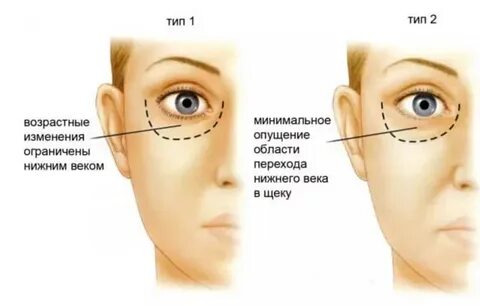 XXX video mening xotinim