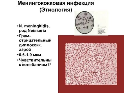 Тесты по менингококковой инфекции с ответами