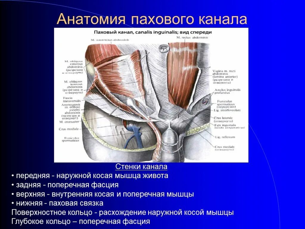 Пращевидная связка. Стенки пахового канала топографическая анатомия. 2. Топографическая анатомия пахового канала.. Паховая связка и наружное паховое кольцо. Паховый канал анатомия стенки.