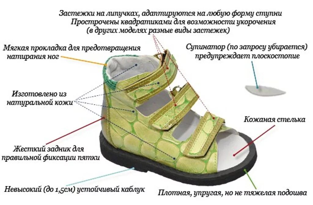 Как выбрать первую обувь для малыша. Ортопедическая обувь для детей при вальгусной деформации. Ортопедическая обувь при косолапии. Правильная ортопедическая обувь для детей. Ортопедические обуви схема.