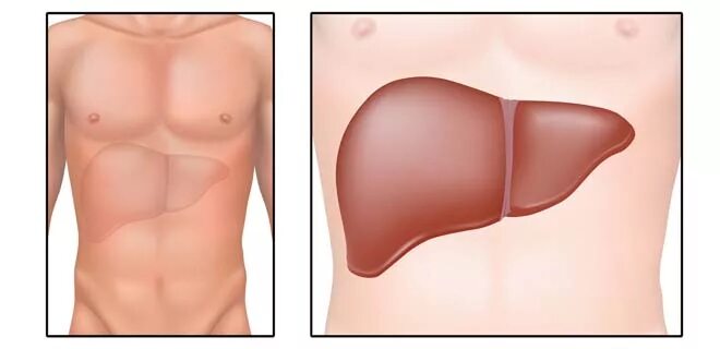 Болит печень увеличена