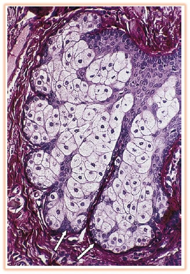 Сальные и потовые железы гистология. Сальная железа гистология. Сальная железа препарат гистология. Потовая железа гистология препарат. Сальная железа гистология.