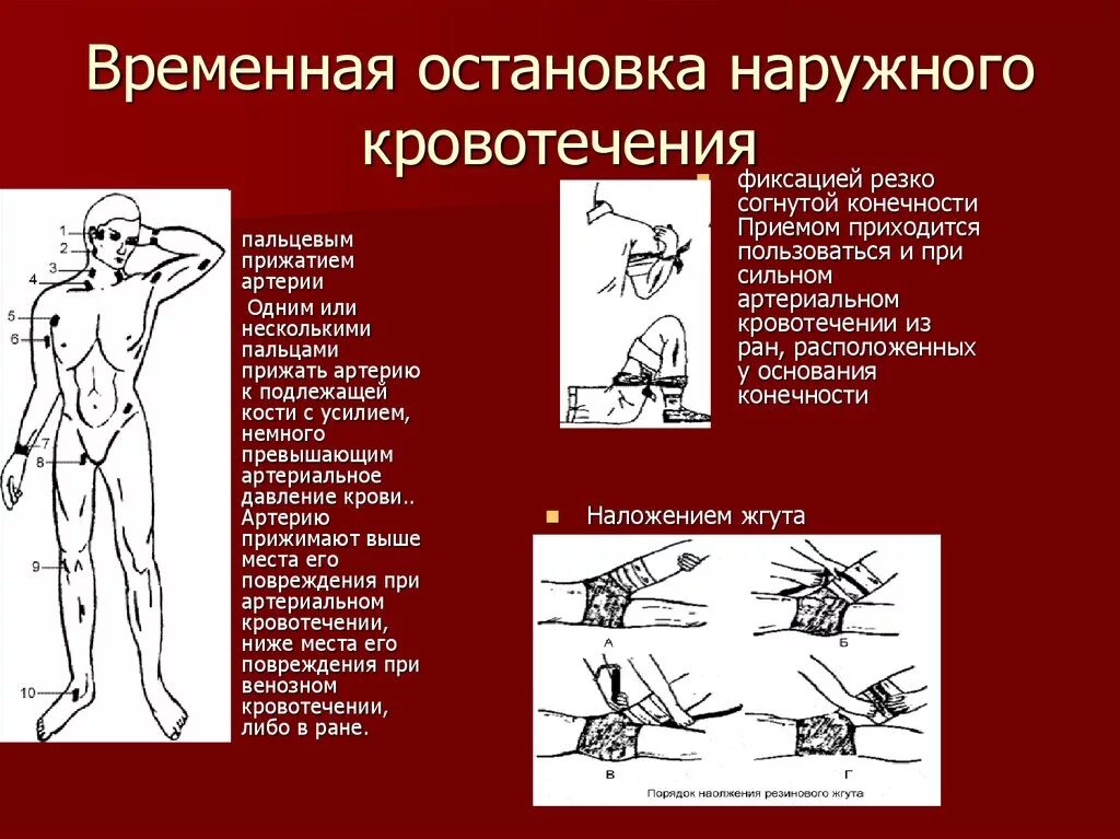 Остановка наружного кровотечения прижатие. Остановка артериального кровотечения прижатие артерий. Остановка наружного кровотечения точки прижатия. Остановка кровотечения методом пальцевого прижатия артерии алгоритм.