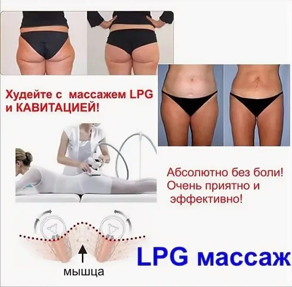 Лпд массаж до и после отзывы Эндосфера терапия. что это, отзывы о массаже для лица, тела, результаты, фото до