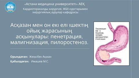 Көйлектің астынан көрінеді