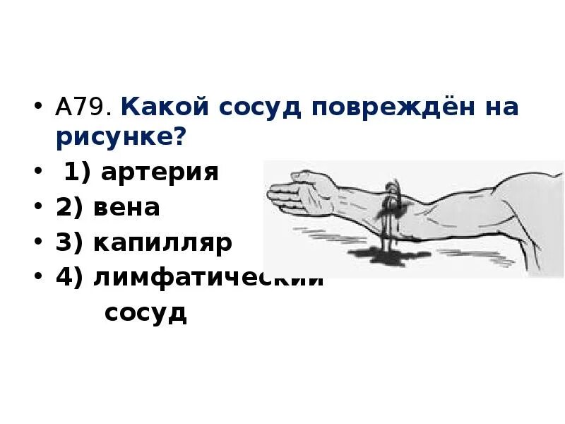 Какой сосуд поврежден. Какой сосуд повреждён на рисунке?. Повреждение артерии рисунок. Поврежденный сосуд рисунок. Какой сосуд повреждён на рисунке лимфатический.