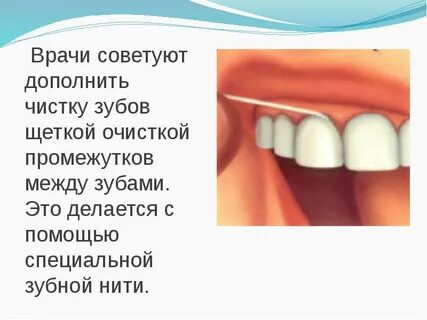 Межзубные промежутки