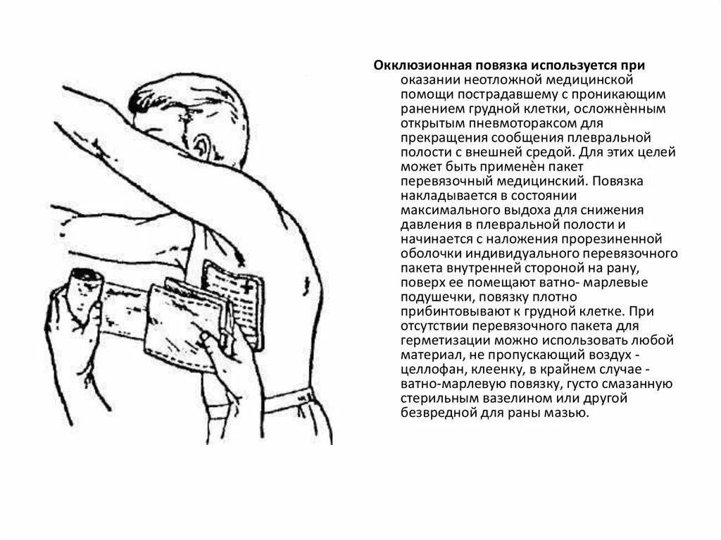 Наложение окклюзионной повязки при пневмотораксе. Наложение окклюзионной повязки при проникающем ранении. Окклюзионной повязки при ранениях грудной клетки. Наложение окклюзионной повязки при проникающем ранении груди.. Наложение окклюзионной повязки при открытом пневмотораксе.