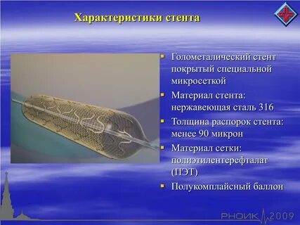 Система стента