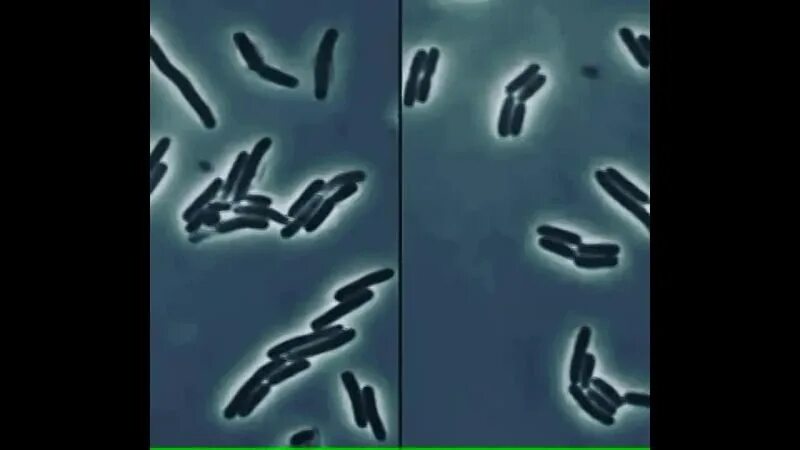 мертвые бактерии. бактерии в воздухе. мертвые бактерии. хеликобактер пилори патогенные микроорганизмы. дохлые микробы.