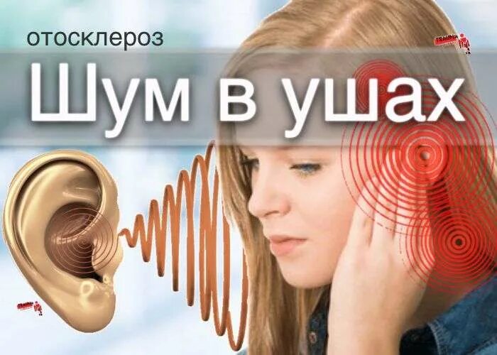 Шум в ушах месяц. Отосклероз и звон в ушах.