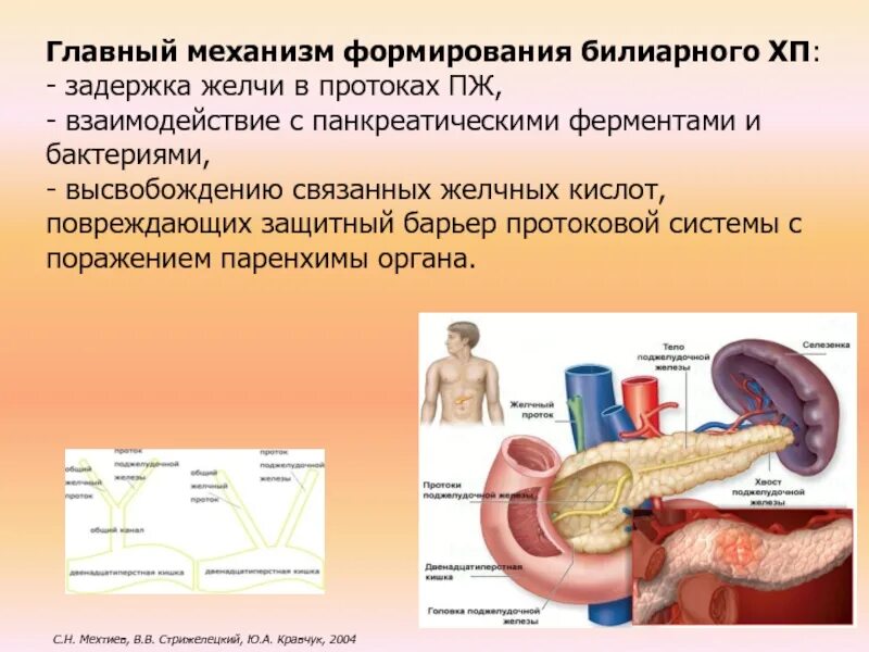 Механизмы формирования дисфункций билиарной системы. Повышение давления в желчном протоке. Задержка при панкреатите. Механизм формирования баров.