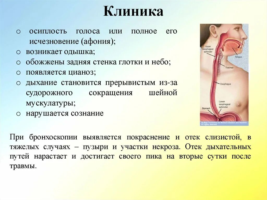 Почему голос часто становится хриплым. Причины осипшего голоса. Осиплость и охриплость голоса. Осиплость голоса причины. Причины охриплости голоса у женщин.