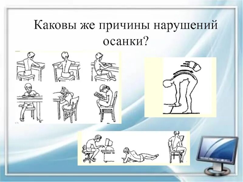 Каковы причины осанки. Причины нарушения осанки. какова главная причина нарушения осанки. каковы причины нарушения осанки физкультура. назовите основные нарушения осанки..