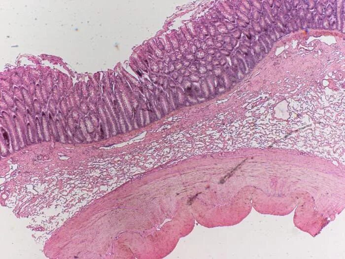 Тонкая слизистая оболочка желудка. Препарат Толстого кишечника гистология. Тонкая кишка гистология препарат. Эпителий Толстого кишечника гистология. Отделы тонкой кишки гистология.